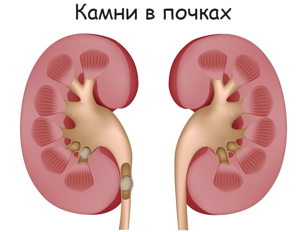 Кракен маркетплейс что это